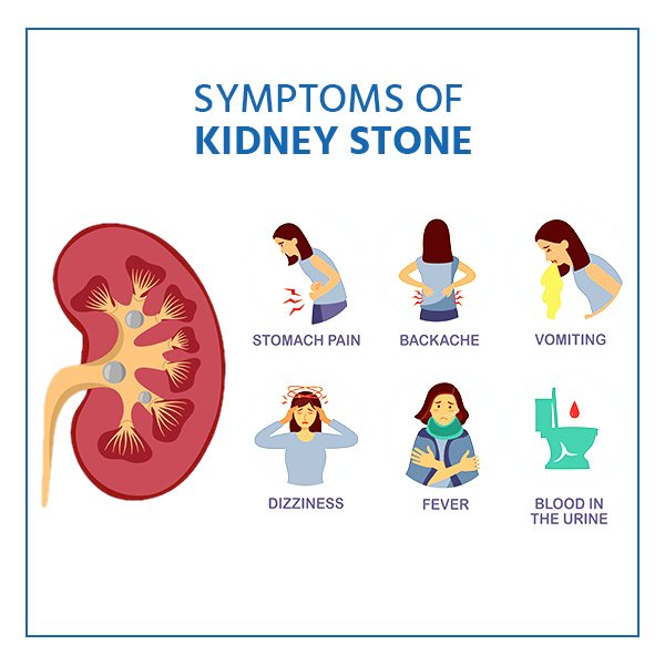 What Are The Symptoms Of Kidney Stones?