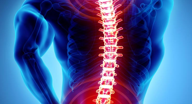 Do You Need Spine Surgery?