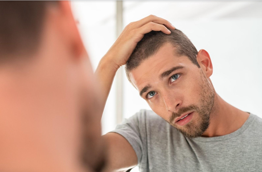 What Causes Itchy Scalp and Hair Loss?