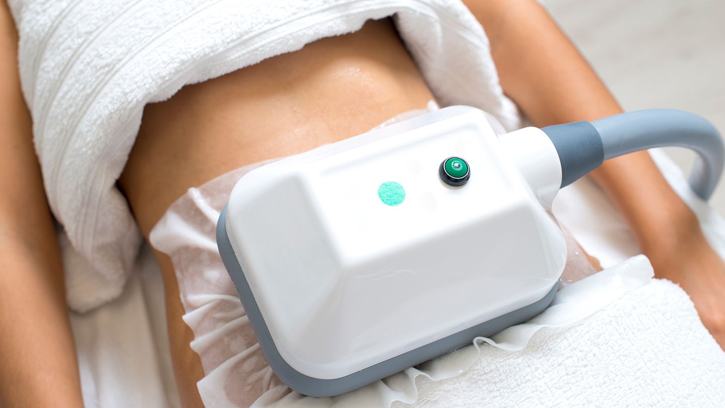 CoolSculpting: Embracing a Cooler Approach to Fat Elimination