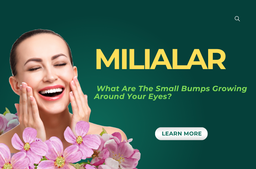 Milialar: What Are The Small Bumps Growing Around Your Eyes?